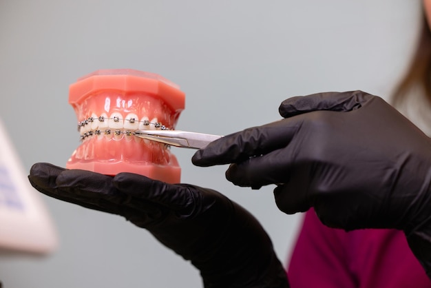 Primo piano delle mani dei medici in guanti neri che tengono modelli di denti con bretelle in ceramica sui denti