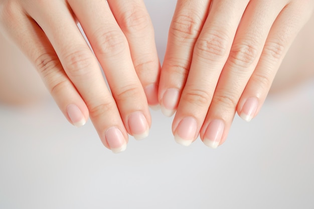 primo piano delle mani e delle unghie della donna su sfondo bianco assistenza sanitaria dell'unghia