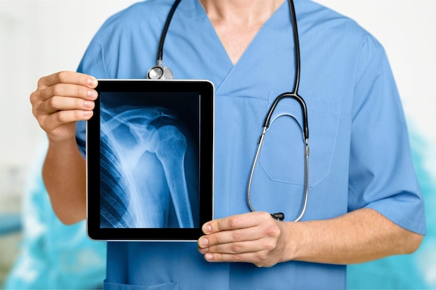primo piano di un medico maschio che tiene in mano un tablet PC con raggi X