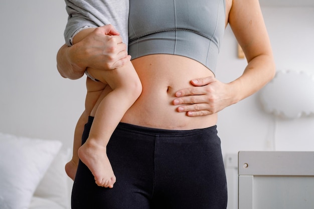 Primo piano di un ventre con cicatrice da taglio Una donna con in braccio un bambino che mostra il suo corpo imperfetto Un addome con cicatrice da taglio cesareo