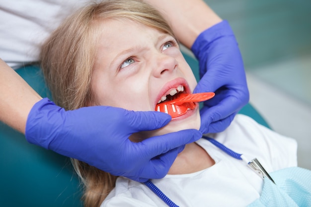 Primo piano di una bambina arrabbiata in poltrona odontoiatrica con impronte di denti fatte dal suo dentista