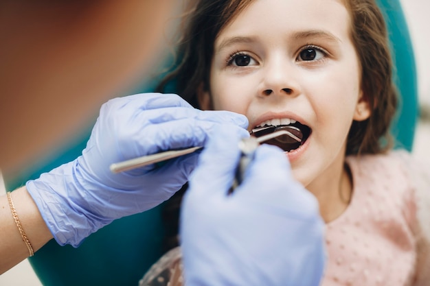 Primo piano di una bella bambina seduta su una sedia per stomatologia con la bocca aperta durante un esame dei denti da parte di un dentista pediatrico.