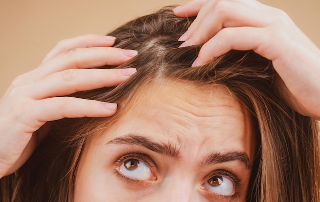 Primo piano di una donna che esamina il cuoio capelluto e la caduta dei capelli sull'attaccatura dei capelli o sul problema del cuoio capelluto secco