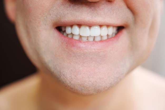 Primo piano la bocca dell'uomo sorride e mostra i denti bianchi