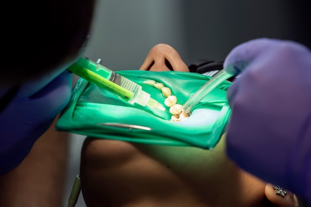 Primo piano sulle mani del dentista facendo trattamenti per i denti