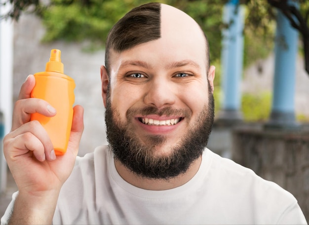 Problema con la caduta dei capelli del cuoio capelluto dello sfondo dell'alopecia degli adulti