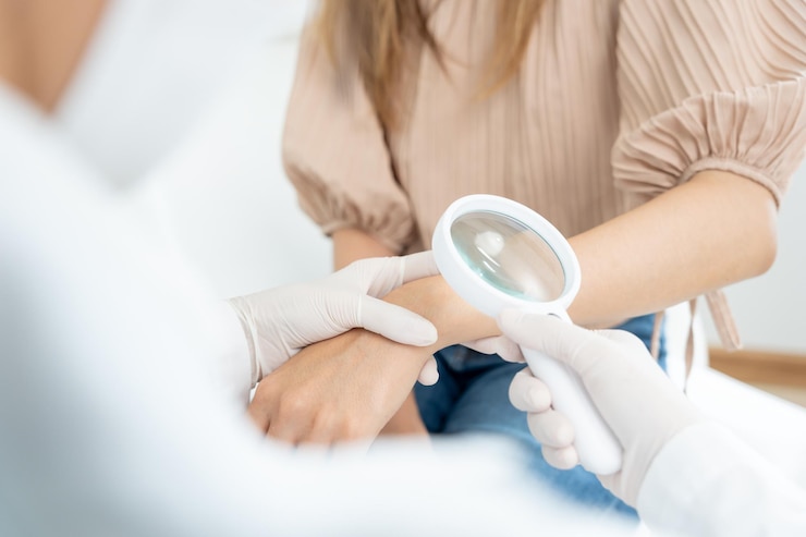 Foto problema della pelle e bellezza di una ragazza asiatica il dermatologo usa la lente d'ingrandimento guarda la pelle pruriginosa dalla pelle allergica allergia agli steroidi pelle sensibile allergia chimica eruzione cutanea punture di insetti dermatite
