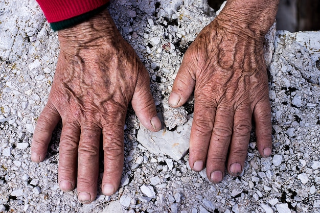 Processo di invecchiamento - molto vecchia donna mani rugose pelle
