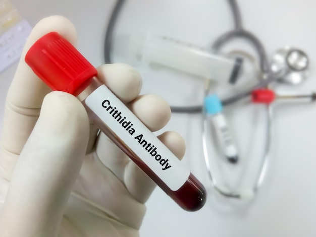 Provetta con campione di sangue per il test degli anticorpi Crithidia