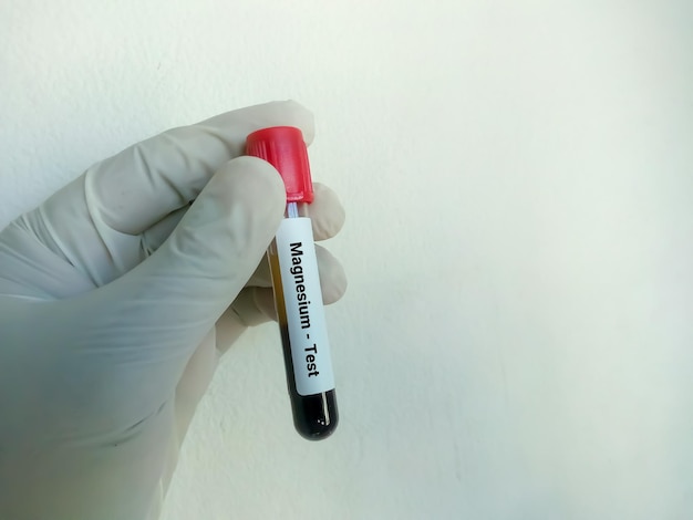 Provetta con prelievo di sangue per il test del magnesio o del Mg