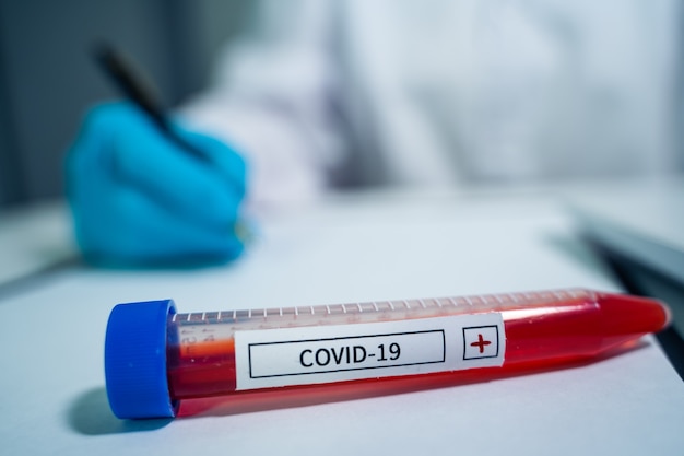 Provetta per campioni di sangue positiva al virus COVID-19 o al nuovo coronavirus 2019 trovato a Wuhan, in Cina