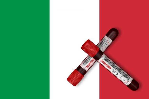Provette con la scritta 2019-nCoV sullo sfondo della bandiera italiana. Rendering 3D
