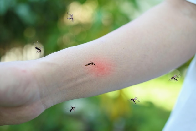 Puntura di zanzara sul braccio adulto con eruzione cutanea e allergia con macchia rossa