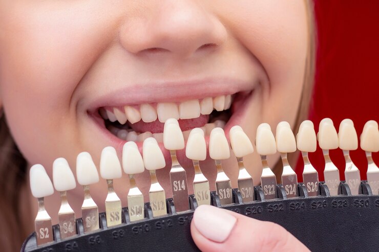 Ragazza sulla procedura di sbiancamento dei denti con la bocca aperta