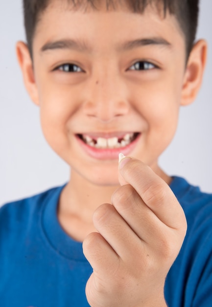 Ragazzino che mostra i denti da latte