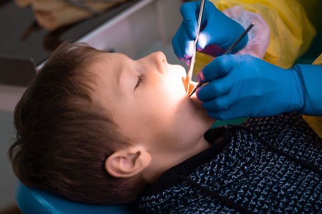 Ragazzo 7-11 sulla poltrona del dentista e le mani del dottore in guanti blu durante l'esame odontoiatrico o il trattamento odontoiatrico