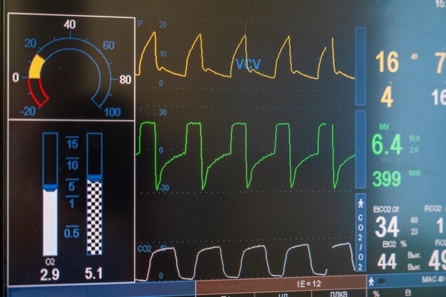 Recupero moderni sistemi di monitoraggio Sanità moderne tecnologie