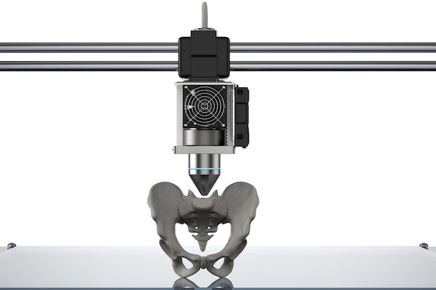 Rendering 3D Stampante 3D Protesi dell'osso dell'anca