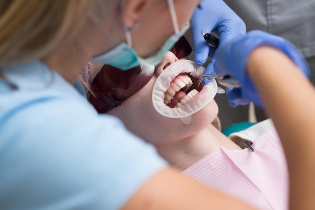 Ritratto del primo piano di una paziente in visita dal dentista per lo sbiancamento dei denti in clinica dentista esam...