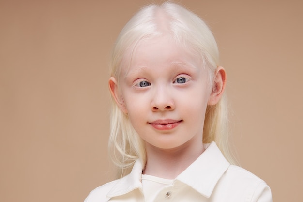 Ritratto della ragazza sorridente del bambino dell'albino isolata