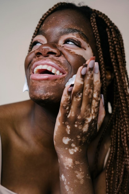 Ritratto di bella donna africana con vitiligine che applica schiuma detergente con una mano mentre sorride