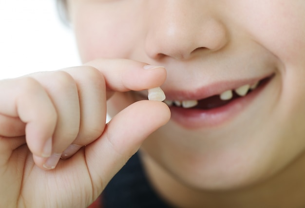 Ritratto di ragazzo carino che perde il suo primo dente