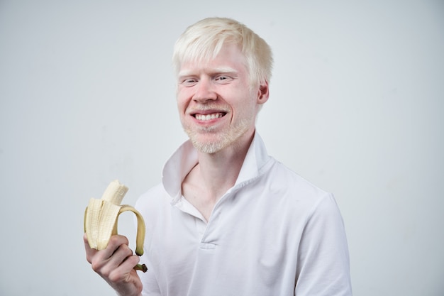 Ritratto di un uomo albino che tiene una banana