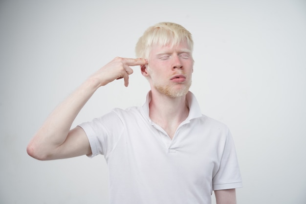 Ritratto di un uomo albino in uno studio