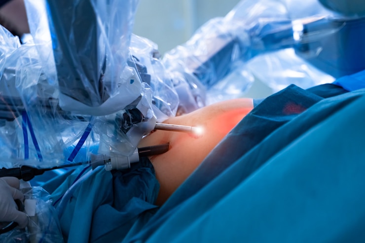 Foto sala chirurgica in ospedale con apparecchiature di tecnologia robotica, robot davinci.