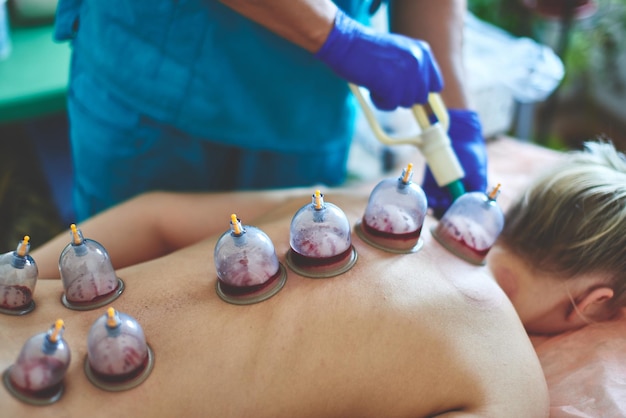 Salasso curativo, hijama o flebotomia. Il maestro Hajam conduce la coppettazione su una giovane donna. Medicina islamica