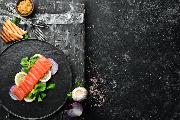 Salmone di pesce salato con limone e cipolle su un piatto nero Vista dall'alto Spazio libero per il testo Stile rustico