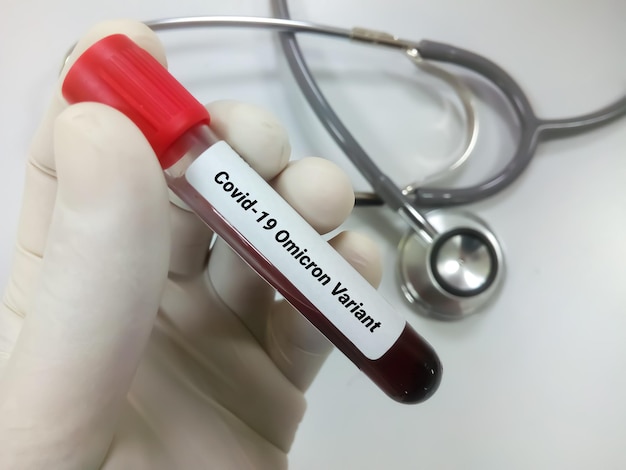 Sangue per covid 19 o coronavirus omicron Test variante