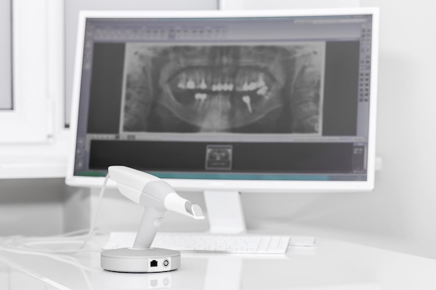 Scanner 3d dentale e monitor nell'ufficio del dentista