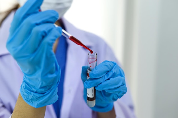 Scienziato che detiene la provetta per campioni di sangue infetto da Coronavirus covid19 Test del DNA del sangue in laboratorio con provette per la raccolta di campioni di sangue e siringa Ricerca sul vaccino Coronavirus Covid19