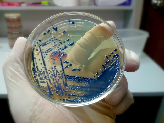 Scienziato che tiene terreni di coltura batterica nel laboratorio di microbiologia