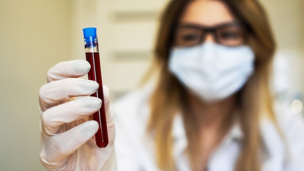 Scienziato femminile che tiene la provetta con il campione di sangue. Il concetto di analisi e diagnostica di virus e malattie. Focus sulla provetta