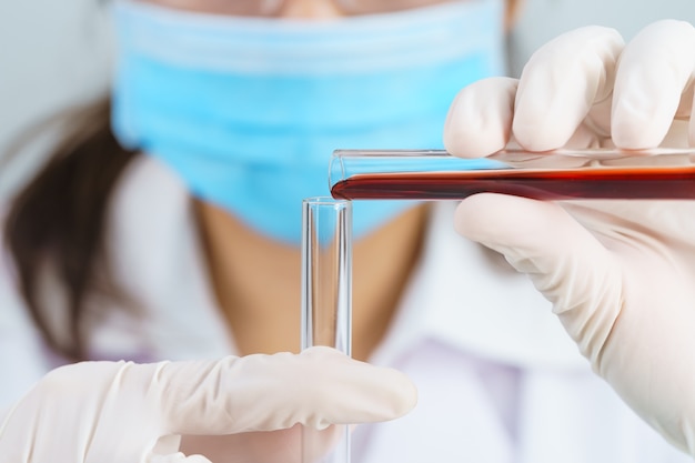 Scienziato tecnico analizzando tenendo il campione di sangue in provetta in laboratorio per il test