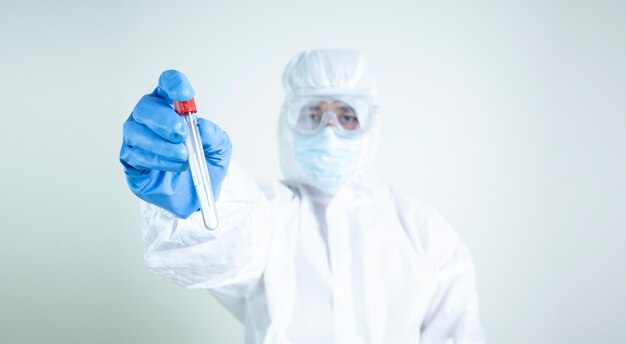 Scienziato tiene il tampone di cotone per verificare la presenza di una malattia epidemica contagiosa covid19