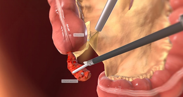 Staccare il rendering 3D del mesentere