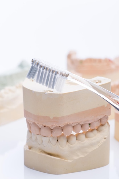 Stampi per denti con spazzolino da denti su un tavolo bianco brillante