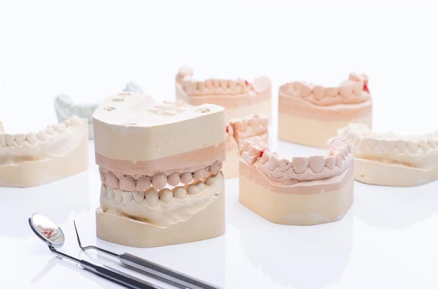 Stampi per denti con strumenti dentali di base su un tavolo bianco brillante