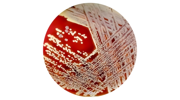 Staphylococcus batteri Gram positivi su agar sangue.