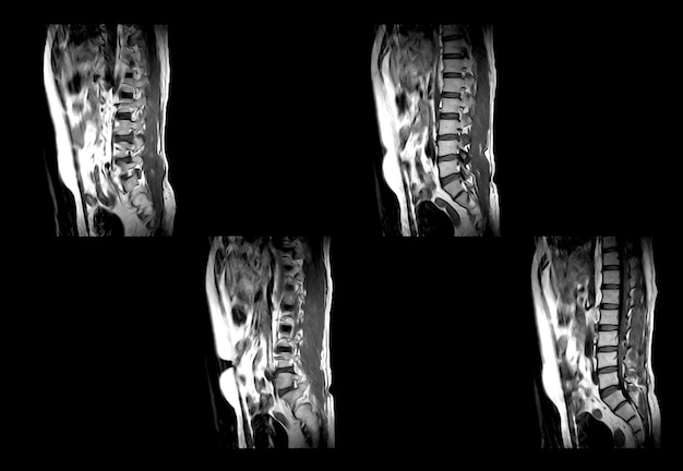 TAC della colonna vertebrale inferiore e immagini professionali MRI