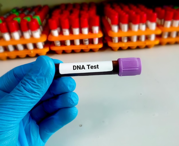 Tecnico o scienziato che tiene una provetta per la raccolta del sangue del campione per il test del DNA in laboratorio