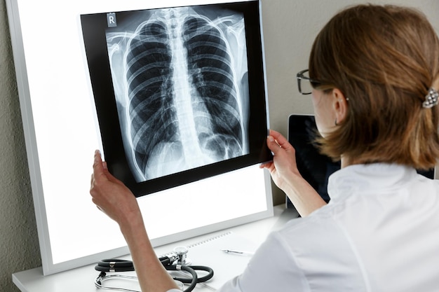 Terapista pneumologo che esamina una radiografia dei polmoni