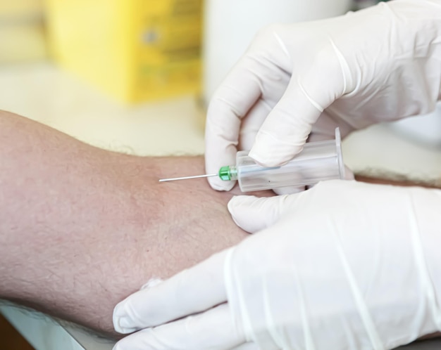 Test del sangue in un moderno laboratorio di ematologia ospedaliera
