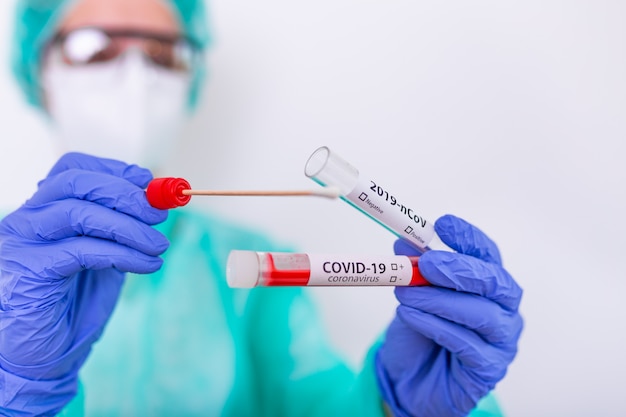 Test di laboratorio su tampone nasale COVID-19 in laboratorio ospedaliero, provetta per infermiere con sangue per analisi 2019-nCoV. Nuovo concetto cinese dell'analisi del sangue del coronavirus.