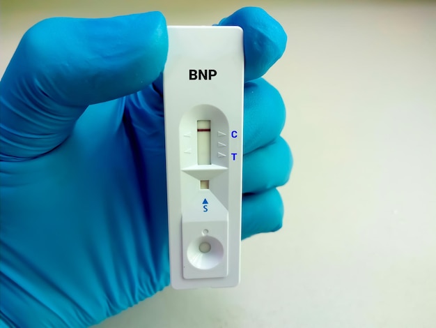 Test di screening rapido Peptidi natriuretici cerebrali o test BNP