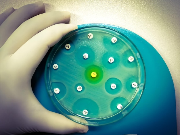 Test di suscettibilità antimicrobica in capsula di Petri. Resistenza agli antibiotici o sensibile ai batteri
