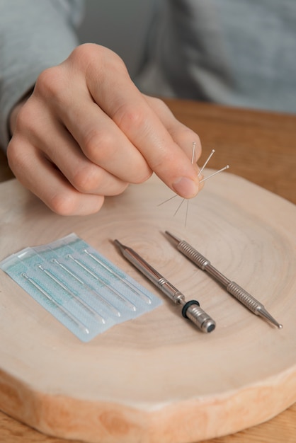 Trattamento di agopuntura sulle mani dell'uomo, aghi.